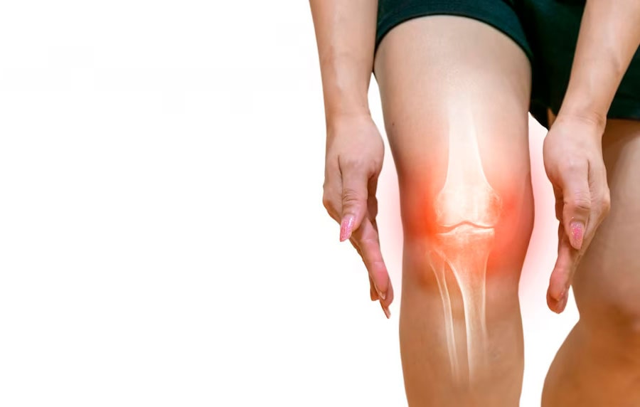 артроз коленного сустава лечение