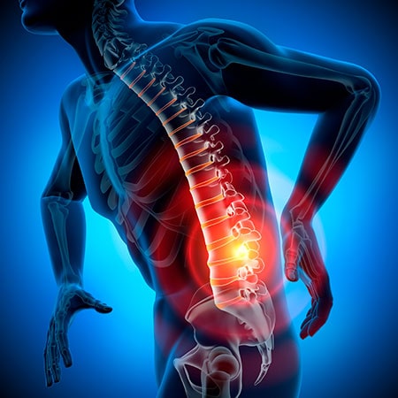 Лечение болей в спине в домашних условиях: мази, растирания, отвары