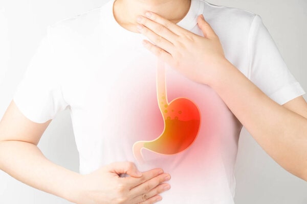 How to treat gastroesophageal reflux disease (GERD) at home
