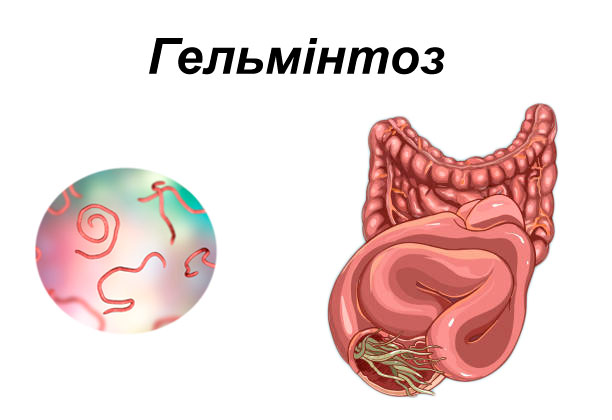 gelmintoz-1-ukr-min.jpg