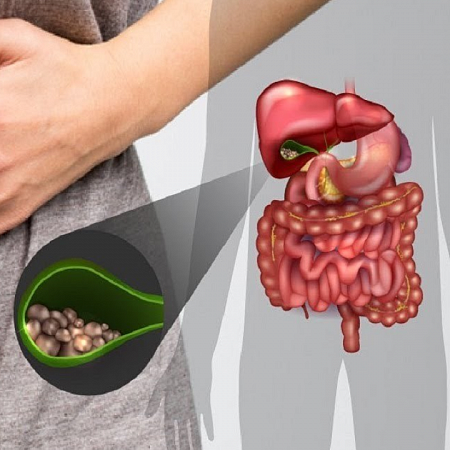 Bolotovov balzam po odstránení žlčníka