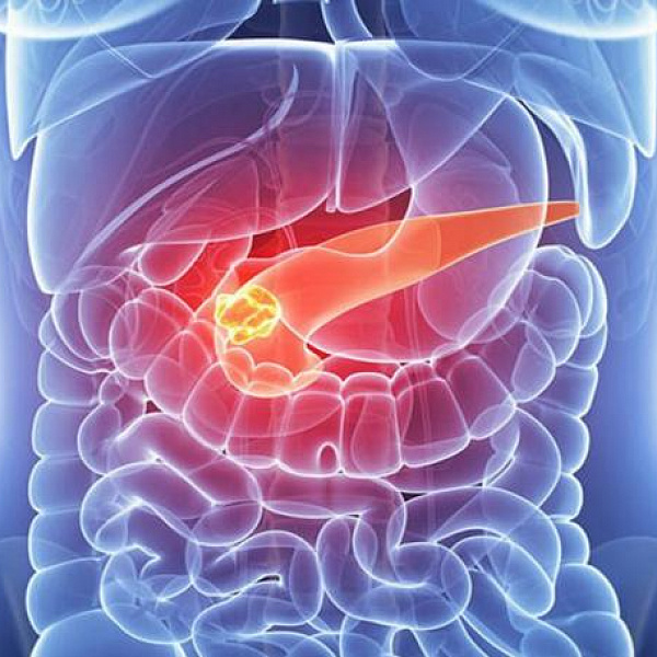 Bolotovov balzam na pankreatitídu