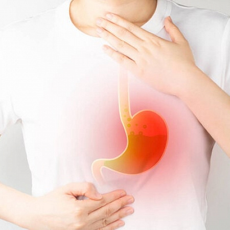 How to treat gastroesophageal reflux disease (GERD) at home