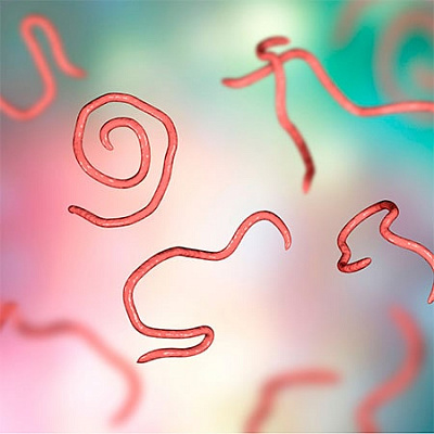 Wurminfektion (Helminthiasis): Wie behandelt man Würmer zu Hause?